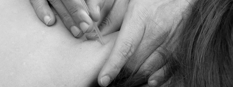 dry needling van-den-langemheen-fysiotherapie-manuele-therapie